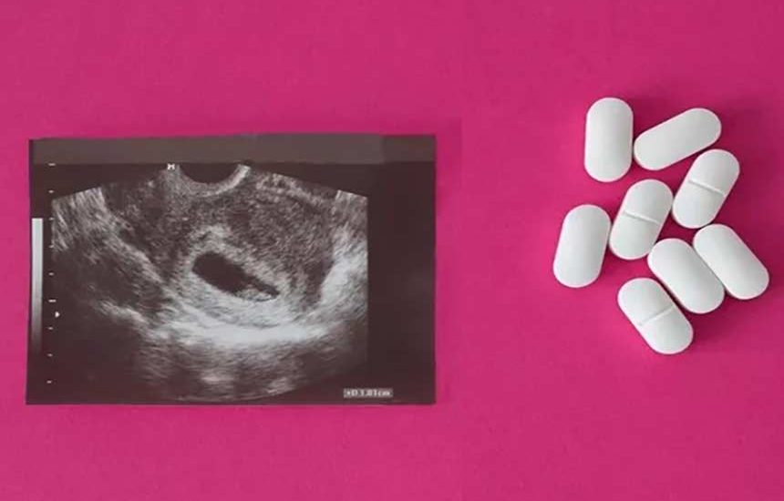 Aborsi Bagi Korban Pemerkosaan